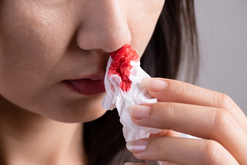 Częste krwotoki z nosa